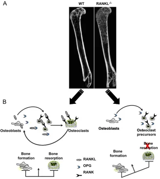 Fig. 1. RANKL is absolutely required for osteoclast differentiation in vivo as revealed by the bone phenotype exhibited by RANKL knockout miceexhibited by RANKL knockout (RANKL