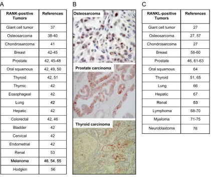 Fig. 2. RANK is expressed by numerous tumour cell typeprostate carcinoma and thyroid carcinoma