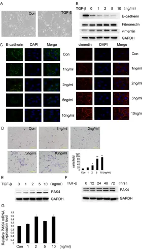 Figure 1. TGF-β1 induced morphological changes and EMT in HK-2 Cells HK-2 cells were treated with 0, 1, 2, 5, 10 ng/ml TGF-β1 for 48 h (E) and and expression of PAK4 in TGF-β1-treated HK-2 C cells