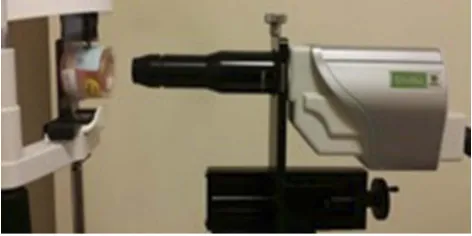 Figure 1 Imaging of a donor cornea through a sealed and sterile case.Abbreviation: HD-OCT, high deﬁnition optical coherence tomography.