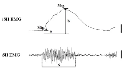 Figure 1. Data analysis. SH EMG and iSH EMG, raw and the end of the SH EMG. See the text for details
