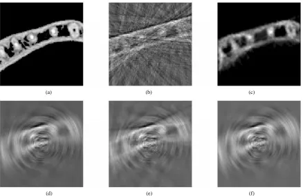 Figure 3. The FBP reconstruction of the Dental Arc-phantom with 5% Gaussian noise. Upper row: (a) The original phantom, (b) Reconstruction from original data and (c) SINT interpolation