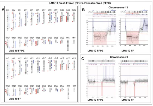 Figure 3. Comparison of Array CGH results in paired Fresh Frozen and Formalin-fixed Paraffin -Embedded samples from LMS 10.Panel A:a function of their chromosomal position with a moving average of probe logblack lines with corresponding shaded blue areas a
