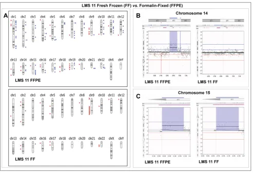 Figure 4. Comparison of Array CGH results in paired Fresh Frozen and Formalin-fixed Paraffin -Embedded samples from LMS 11.