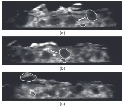 Figure 17. Grain collision during the test PSD11up-b: (a) before theimpact; (b) grain interaction; (c) after the collision