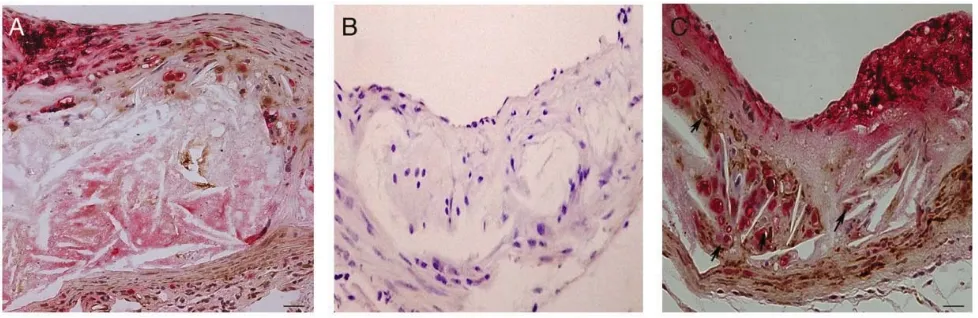 Figure 4. Tribbles 3 staining in experimental mouse atherosclerosis. A Dual staining of trb-3 (brown) and macrophages (Gal3); B negative control (secondary Ab only); C dual staining as A to show some coincident trb-3 and macrophage staining to show an equa