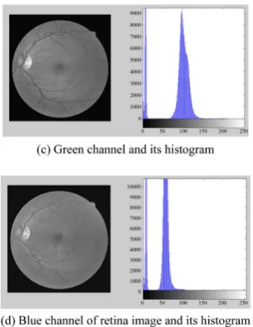 Figure 3. Original retina image, RGB channels and their histograms.                                 