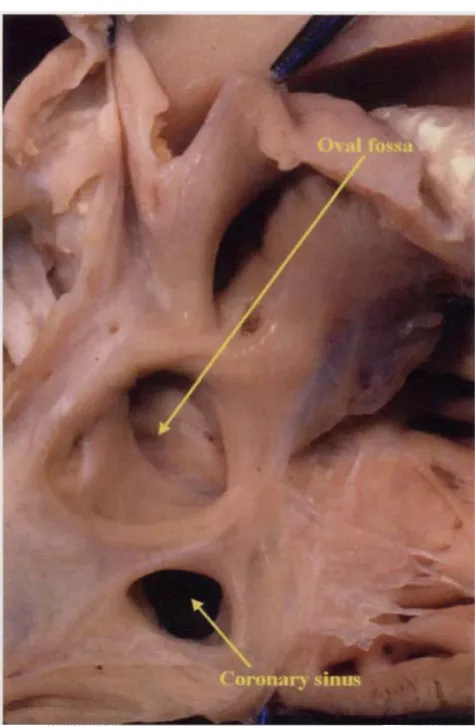 Figure 15.