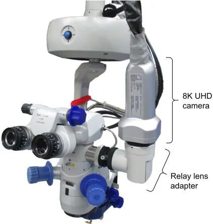 Figure 1 Our new 8K UhD camera mounted on a surgical microscope with a relay lens adapter.Abbreviation: UHD, ultra-high-definition.