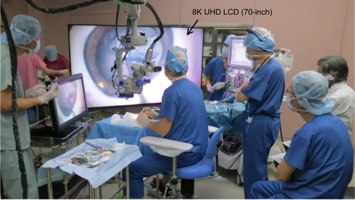 Figure 2 8K UHD microscopic camera for ophthalmic surgery in the operating room site.Abbreviation: UHD, ultra-high-definition.
