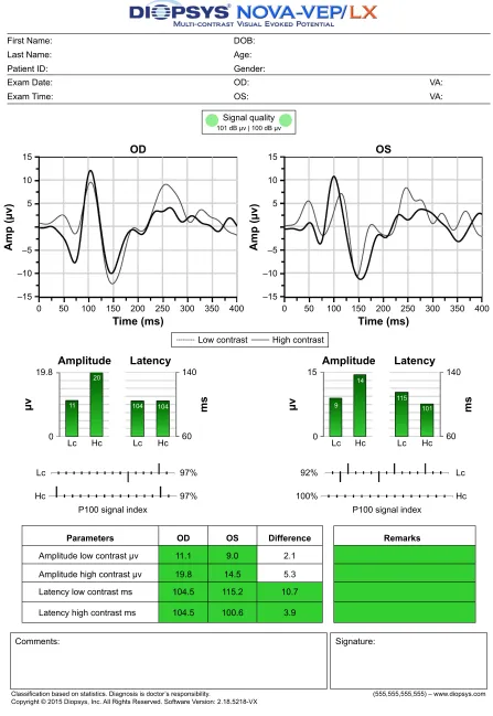 Figure 2 representative VeP report generated by the Diopsys nOVa device.Note: Permission received from Diopsys inc