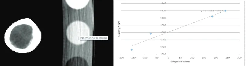 Fig. 1. (a) Screen capture shows scanned bone sample and Calibration Phantom position with grey-scale values; (b) graph shows grey-scale to density relationship