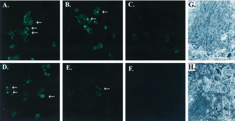 Figure 3.Identifcation of�and organelles that were intact (microscopy. BE-M17 cells stably transfected with A53T �-synuclein aggregates by thioﬂavine S staining and by electron microscopy