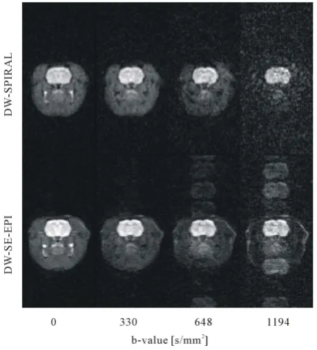 Figure 5. Phantom experiment results with different k-space acquisition orders for the water/glycerol phantoms