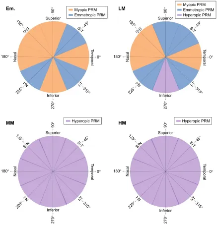 Figure 7 PrM patterns in different subject groups.Note: Color patterns are only for illustration purpose to distinguish myopic, hyperopic or emmetropic PrM and not to represent the actual data.Abbreviations: em., emmetropic; hM, high myopic; lM, low myopic; MM, moderate myopic; PrM, peripheral relative M.