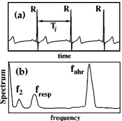 Figure 1�calledtween the two consecutive heart beats and in terms of non-linear dynamics the time intervals between the trajectory’sreturn to a secant plane deﬁned by the value of a threshold,i.e., return times