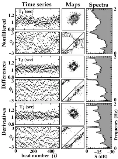 FIG. 4. This ﬁgure illustrates the successive stages of R-Rprocessing and compares the two ﬁltering techniques for a healthy datasubject at rest
