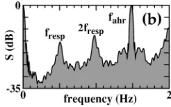 Fig. 12 forFIG. 5. Map of radii of return times for the subject illustrated by �a� nonﬁltered R-R intervals, �b� R-R intervals ﬁltered bydifferences, �c� R-R intervals ﬁltered by derivatives.