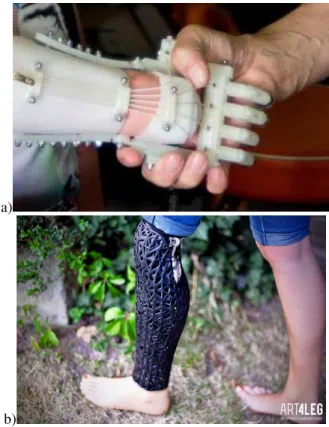 Fig. 6.  3D Printed prosthetics for:  