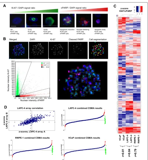 Figure 4 Functional RNAi profiling of GPCR coding genes with prostate cell lines. (A) An antibody based assay for detection of nuclear Ki-67 and cleaved PARP was used for microscopic analysis of cell proliferation and induction of apoptosis (blue = DNA, re