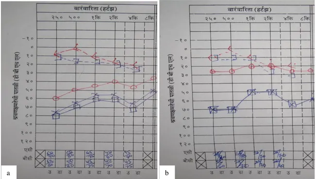 Figure 1: (a) Preoperative PTA, (b) post-operative PTA. 