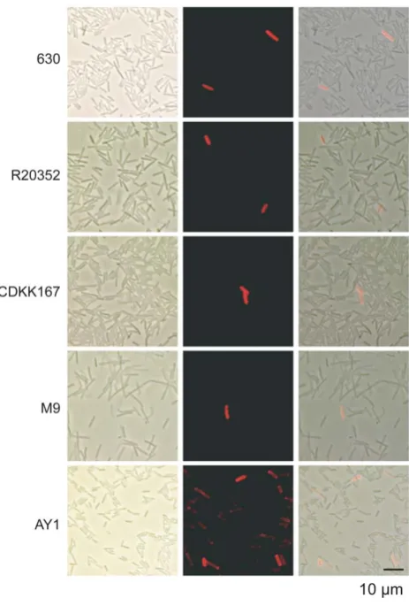Figure 5. Expression of all CwpV types is phase variable.Overnight C. difficile cultures of each strain were stained with theappropriate anti-CwpVrpt antibody (630, rptI; R2035, rptII; CDKK167,rptIII; M9, rptIV; AY1, rptV) then with anti-rabbit rhodamine r