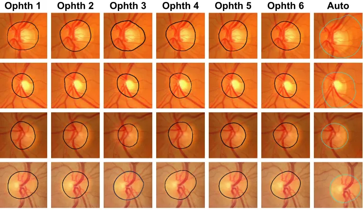 Figure 5 examples of good disc segmentation results for both TiFF (MessiDOr and Magrabi) and JPg (Bin rushed) images comparing with those of six ophthalmologists.