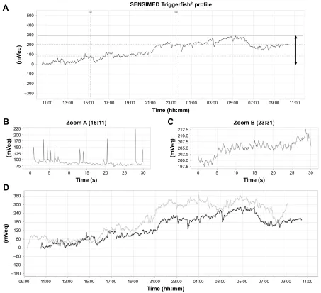 Figure 1 Example of the results of IOP fluctuation measurement over 24 h periods before and after AIT fluctuation before surgery