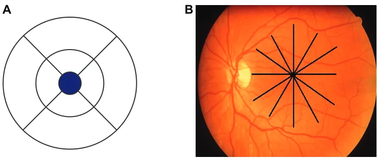 Figure 2 schematic illustration of the macular map showing three concentric rings, with the central ring corresponding to the fovea (1 µm diameter), the middle ring corresponding to the perifovea (2 µm diameter), and the outer ring corresponding to the parafovea (3 µm diameter).