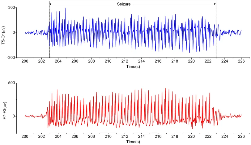 Fig. 5.(a)-(c): The detected time shift ofdetected time shift of Y in front of X using the cross correlation method with different sizes of window h; (d)-(f): The Y in front X using the ERR-Causality test with different sizes of window h.
