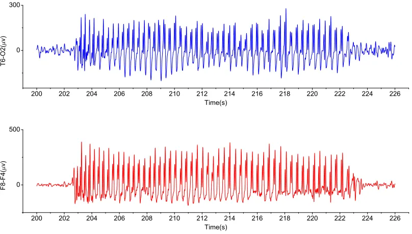 Fig. 9.The recorded EEG signals from the right brain.