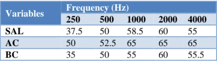 Table 1: The maximum level of bone conducted  narrow band noise for each frequency. 