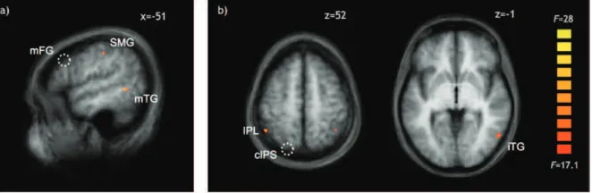 Table 2task in the tool action condition (left IPL, t = 4.1, P < 0.005),Brain regions/Brodman areas (BAs) identiﬁed by the functional connectivity analysis for the 2