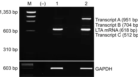 Figure 1 rT-PCr products of lTa mrna detected by 3% agarose gel electrophoresis stained by ethidium bromide.Notes: mrna expression of lTa was detected in the two peripheral blood samples 