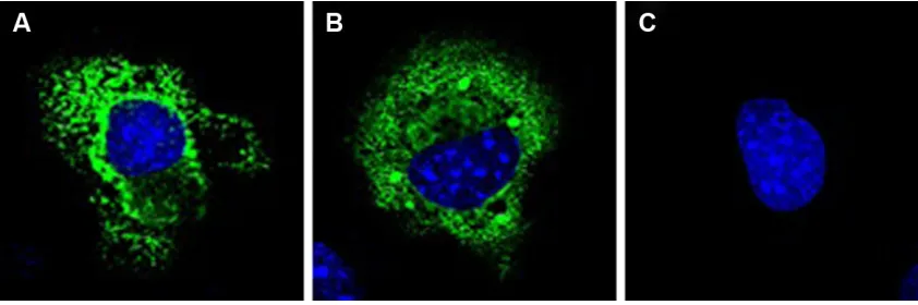 Figure 2 expression analysis of T and C alleles of lTa rs2229094 polymorphism.Notes: COs1 cells were transfected with plasmids encoding lTa-C allele (pCeFl-Flag-lTa-C) and lTa-T allele (pCeFl-Flag-lTa-T)