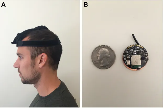 Figure 2 (A) The translucent box represents the ideal position while the “happy face” represents the patient’s actual head position relative to it