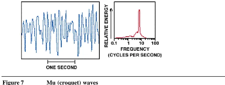 Figure 7 Mu (croquet) waves 