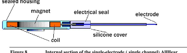 Figure 8 Internal section of the single-electrode ( single channel) AllHear 