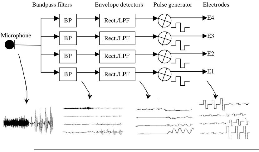 Figure 11 Operation of a 4-channel cochlear implant. 