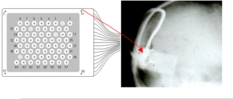 Figure 13 showing the electrodes and position on skull.   