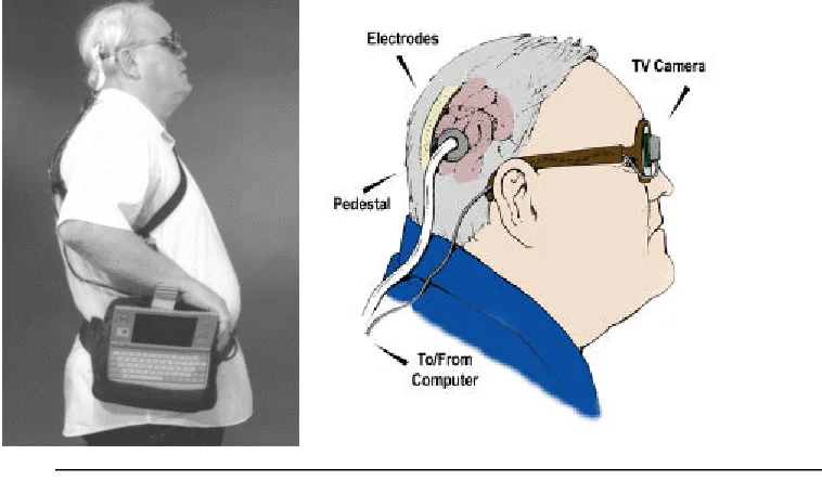 Figure 14 Complete artificial vision system showing the computer and electronics package on the belt with output cable to the electrodes