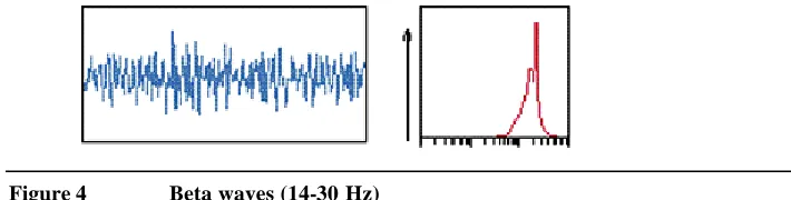 Figure 4 Beta waves (14-30 Hz) 