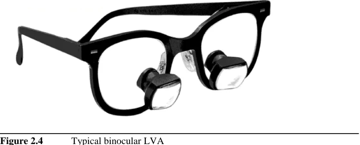 Figure 2.4Typical binocular LVA