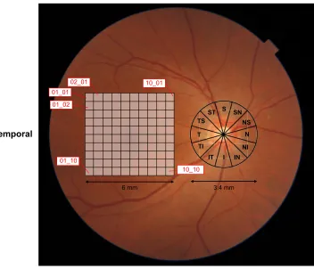 Figure 1 an example of the location pattern of 10×10 grids in the 6×6 mm analysis area and 3.4 mm diameter circle centered on the disc.Abbreviations: s, superior; n, nasal; i, inferior; T, temporal.