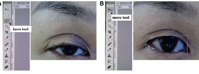 Figure 2 image processing using adobe Photoshop®.Notes: (A) Circumscribe the eye margin using the lasso tool