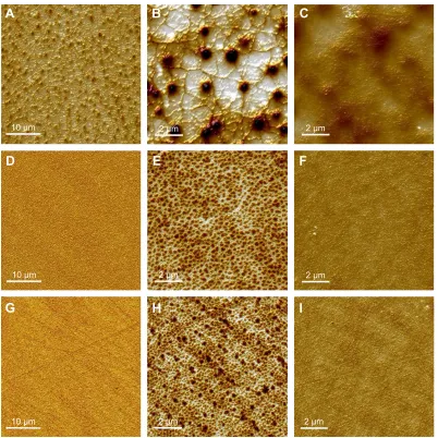 Figure 1 aFM topographical images.Notes: Dry balafilcon A (A, B), senofilcon A (D, E), and samfilcon A (G, H) sihy lenses at small (10×10 µm) and large (40×40 µm) scan size, respectively; images after overnight incubation with 0.1%, (w/v), HA solution of b