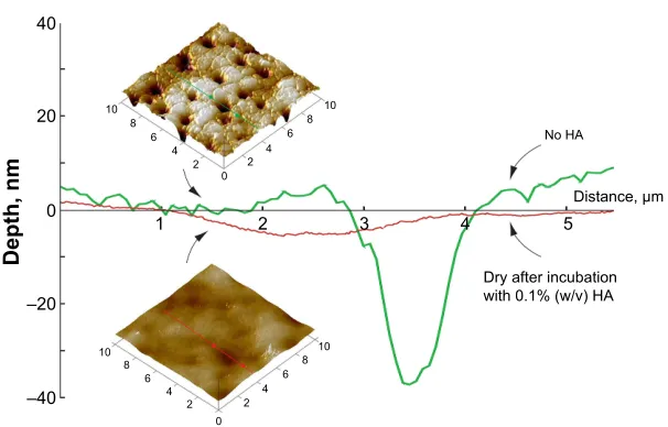 Figure 2 AFM section analysis of balafilcon A before and after overnight incubation with 0.1% (w/v) HA solution.Notes: Samples were characterized in a dry state by soft tapping in air