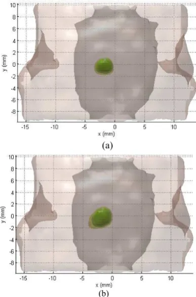 Figure 11 Recovered inclusion using (a) the full FEM model and (b) the reduced order model