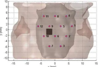 Figure 8 Top view of optode locations. The black object  indicates the location of the active area