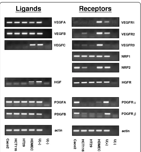 Figure 1 mRNA expression of angiogenesis factors and theirreceptors in three human colon cancer cell lines